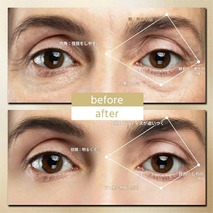 楽天市場】目元ケア EMS 美顔器 目元マッサージャー ems アイ