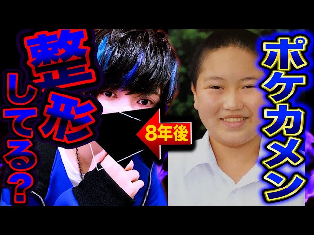 僕の整形疑惑について全てお話します - YouTube