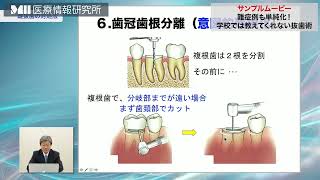 株式会社 医療情報研究所 | 難症例も単純化！学校では教えてくれない抜歯術