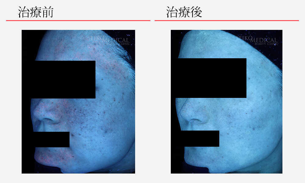 Wテクスチャーリペア | ゼオスキンヘルス｜セイコメディカルビューティ