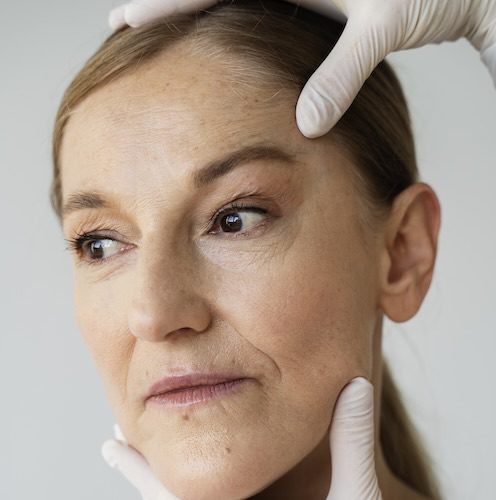 Cambia ahora con nuestro Lifting Facial